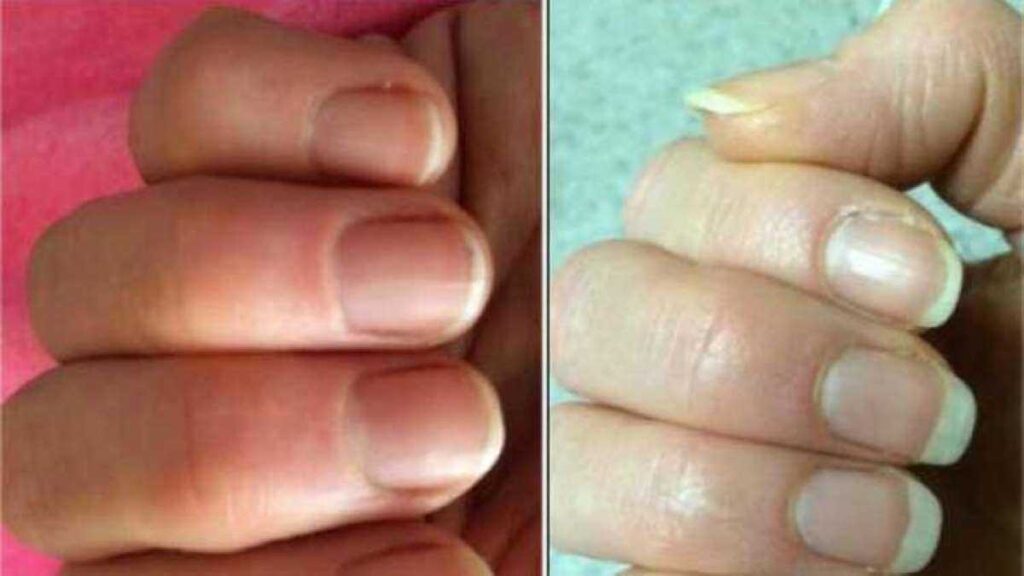 Le Remède de Grand-Mère Pour Faire Pousser Vos Ongles PLUS Vite.