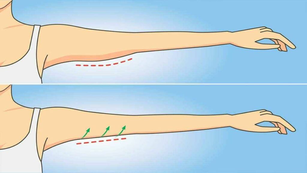 6 exercices simples pour se débarrasser des bras flasques