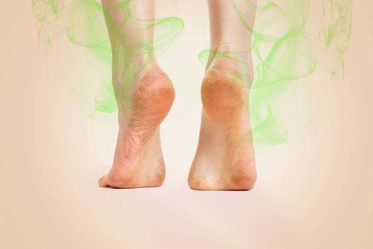 Voici comment se débarrasser des odeurs de pieds avec des remèdes naturels
