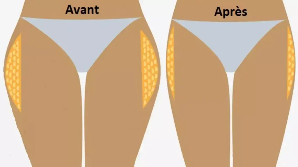 Exercices pour dessiner les hanches et réduire le tour de taille