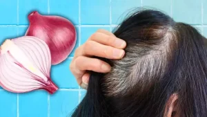 Voici comment utiliser l’oignon pour stimuler la pousse des cheveux