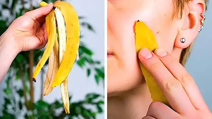 Pourquoi faut-il frotter la peau de banane sur son visage une fois par semaine ? 