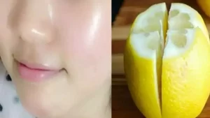 Utilisez le citron pour éliminer les taches de votre visage et avoir une peau radieuse en deux jours