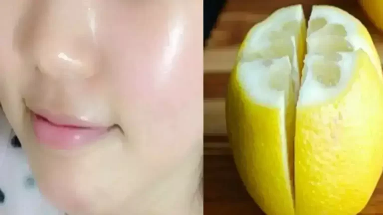 Utilisez le citron pour éliminer les taches de votre visage et avoir une peau radieuse en deux jours