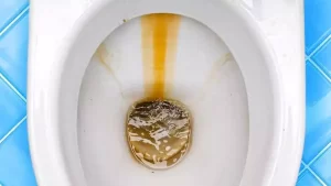 Taches marrons dans les toilettes ? 2 ingrédients suffisent pour garder les WC blanches pendant des mois